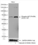 Phospho-AKT (Thr308) Antibody in Western Blot (WB)