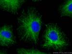 PLEC Antibody in Immunocytochemistry (ICC/IF)