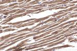 PLEC Antibody in Immunohistochemistry (Paraffin) (IHC (P))