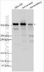 PLEC Antibody in Western Blot (WB)