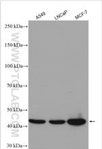 SULT2B1 Antibody in Western Blot (WB)