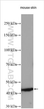 SULT2B1 Antibody in Western Blot (WB)