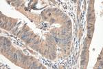 SEMA4B Antibody in Immunohistochemistry (Paraffin) (IHC (P))