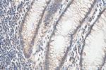 SEMA4B Antibody in Immunohistochemistry (Paraffin) (IHC (P))