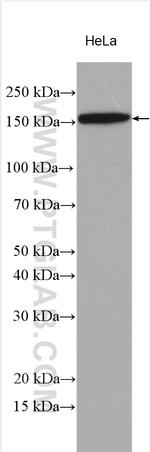 DSG2 Antibody in Western Blot (WB)
