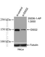 DSG2 Antibody in Western Blot (WB)