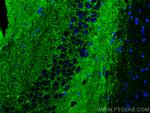 VGLUT2 Antibody in Immunohistochemistry (PFA fixed) (IHC (PFA))