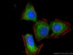 TYW3 Antibody in Immunocytochemistry (ICC/IF)