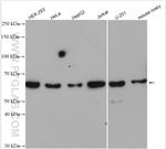 CDK17 Antibody in Western Blot (WB)