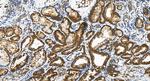 ALG9 Antibody in Immunohistochemistry (Paraffin) (IHC (P))