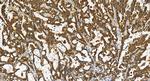 ALG9 Antibody in Immunohistochemistry (Paraffin) (IHC (P))