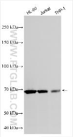 ALG9 Antibody in Western Blot (WB)