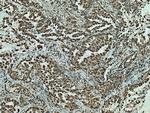 CBLL1 Antibody in Immunohistochemistry (Paraffin) (IHC (P))