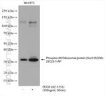 Phospho-RPS6 (Ser235, Ser236) Antibody in Western Blot (WB)