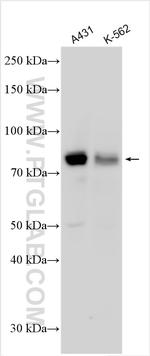 RPS6KA1 Antibody in Western Blot (WB)