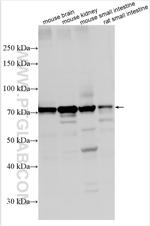 CLCN7 Antibody in Western Blot (WB)