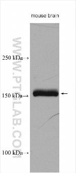 nNOS Antibody in Western Blot (WB)