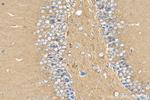 PPP2R2B/A/C/D Antibody in Immunohistochemistry (Paraffin) (IHC (P))