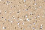 PPP2R2B/A/C/D Antibody in Immunohistochemistry (Paraffin) (IHC (P))
