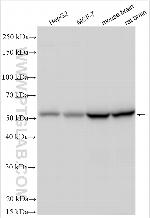 PPP2R2B/A/C/D Antibody in Western Blot (WB)