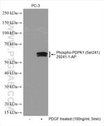 Phospho-PDPK1 (Ser241) Antibody in Western Blot (WB)