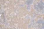 HDAC4 Antibody in Immunohistochemistry (Paraffin) (IHC (P))