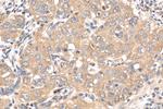 HDAC4 Antibody in Immunohistochemistry (Paraffin) (IHC (P))