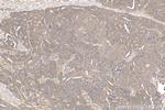 HDAC4 Antibody in Immunohistochemistry (Paraffin) (IHC (P))