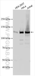 HDAC4 Antibody in Western Blot (WB)
