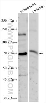 KLHL14 Antibody in Western Blot (WB)