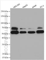 HEXA Antibody in Western Blot (WB)