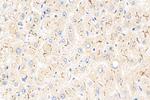 MRP2 Antibody in Immunohistochemistry (Paraffin) (IHC (P))