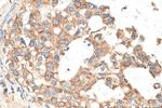 MAP3K2 Antibody in Immunohistochemistry (Paraffin) (IHC (P))