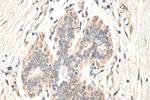 MAP3K2 Antibody in Immunohistochemistry (Paraffin) (IHC (P))