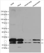 TMEM41B Antibody in Western Blot (WB)
