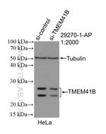 TMEM41B Antibody in Western Blot (WB)
