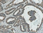 GAB2 Antibody in Immunohistochemistry (Paraffin) (IHC (P))