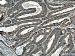 SAP 97 Antibody in Immunohistochemistry (Paraffin) (IHC (P))