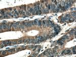 SAP 97 Antibody in Immunohistochemistry (Paraffin) (IHC (P))