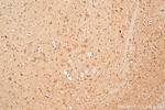 BRWD1 Antibody in Immunohistochemistry (Paraffin) (IHC (P))