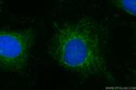 GDF9 Antibody in Immunocytochemistry (ICC/IF)