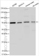 GDF9 Antibody in Western Blot (WB)