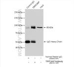 TRPC4AP Antibody in Immunoprecipitation (IP)