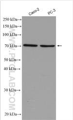 FOXP4 Antibody in Western Blot (WB)