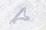 METTL3 Antibody in Immunohistochemistry (Paraffin) (IHC (P))