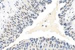 METTL3 Antibody in Immunohistochemistry (Paraffin) (IHC (P))