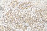 METTL3 Antibody in Immunohistochemistry (Paraffin) (IHC (P))