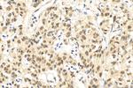METTL3 Antibody in Immunohistochemistry (Paraffin) (IHC (P))