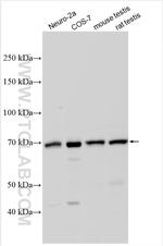 METTL3 Antibody in Western Blot (WB)