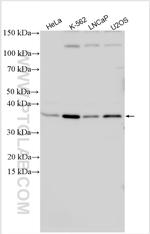 CDCA5 Antibody in Western Blot (WB)